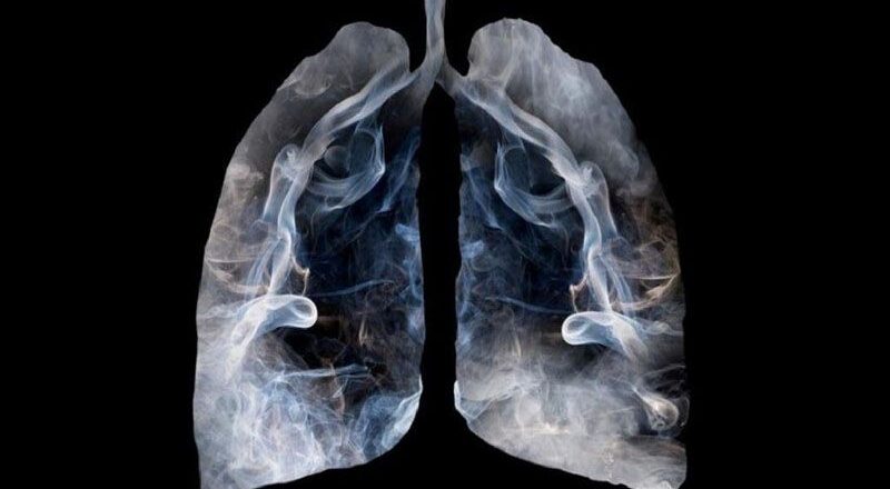 El tabaco y su vínculo con el cáncer de pulmón